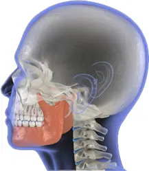 xray model of a jaw muscle and skull